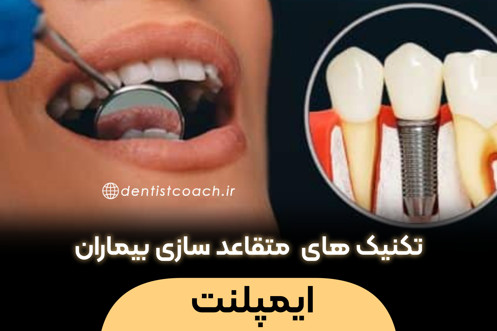 دوره ی آموزشی متقاعد سازی در طرح درمان بیماران ایمپلنت
